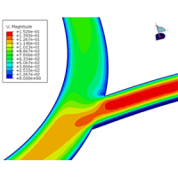 abaqus-tutorial-pulsating-flow-in-a-bifurcated-vessel-with-abaqus-cfd